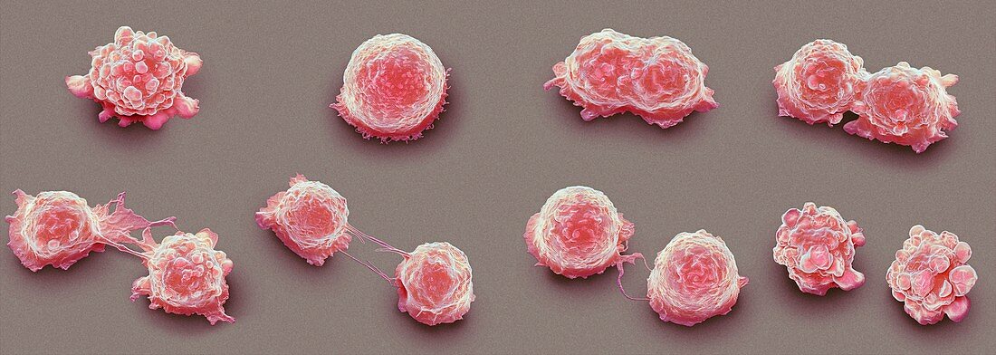 Cancer cell division,SEM