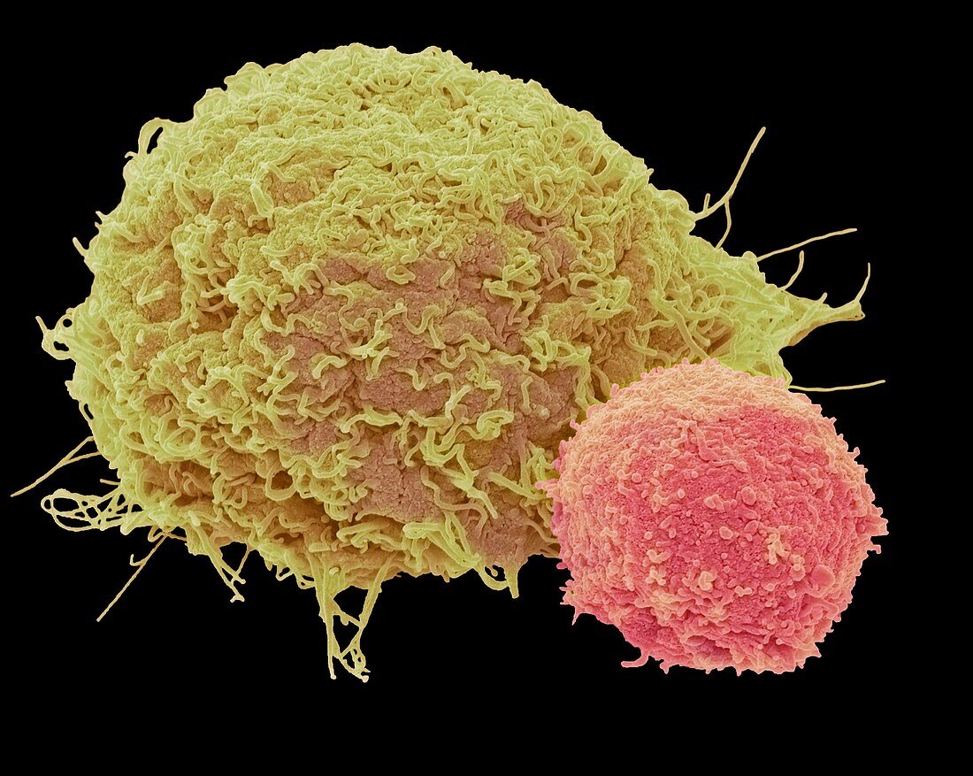 T lymphocyte and cancer cell,SEM