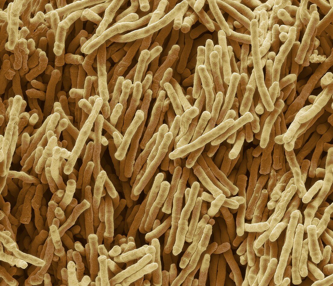 Mycobacterium smegmatis bacteria,SEM