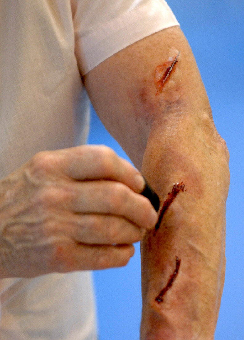 Simulated arm lacerations