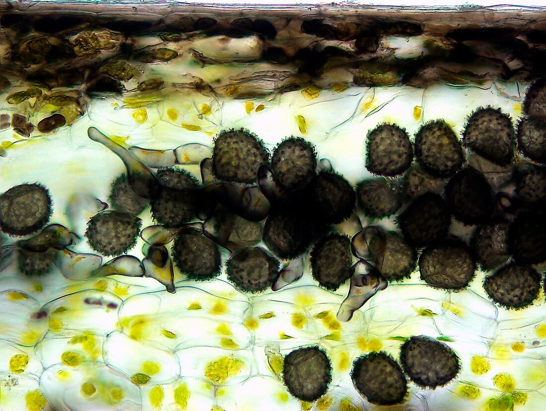 Hornwort sporocytes,light micrograph