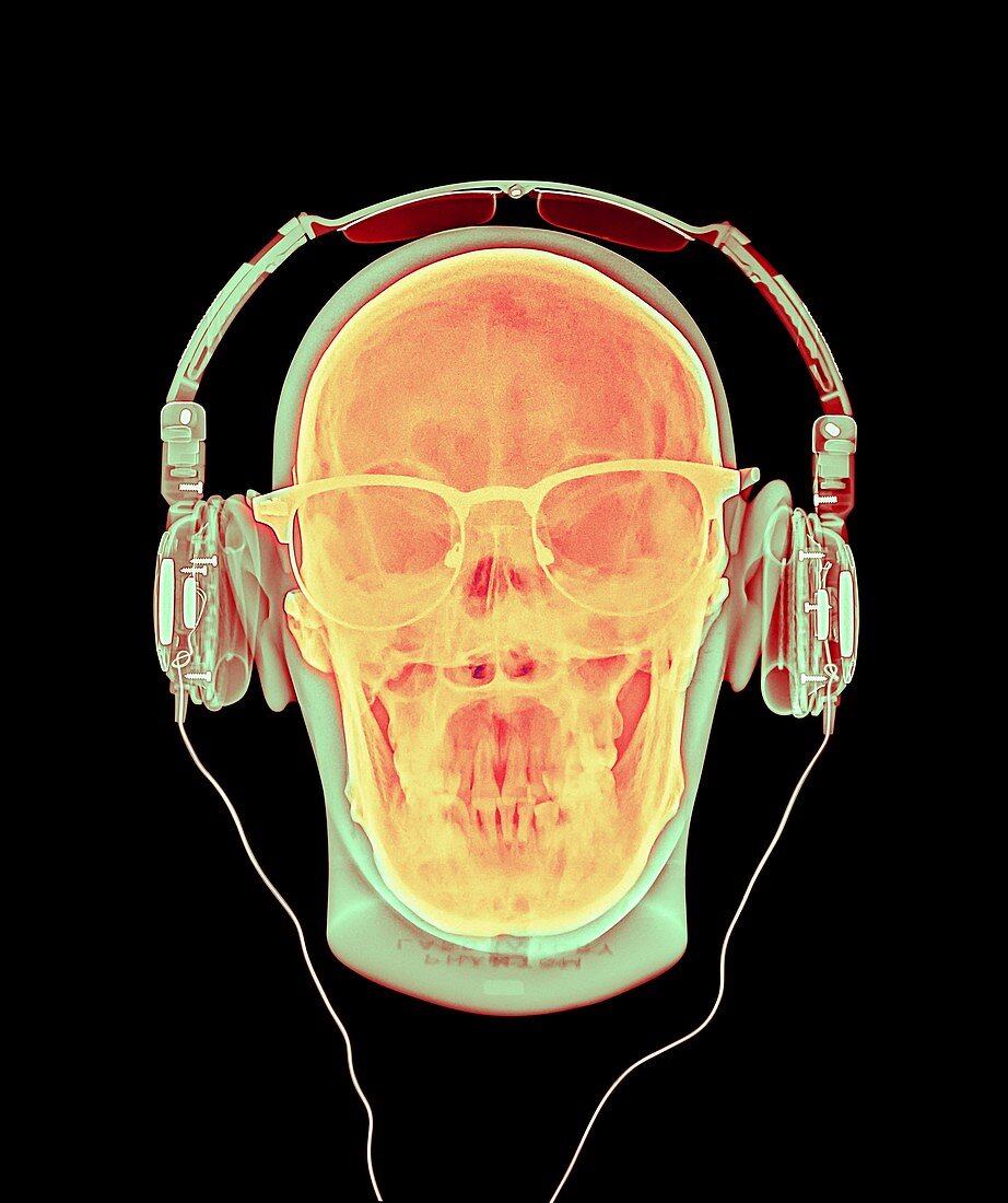 Skull with headphones and glasses,X-ray
