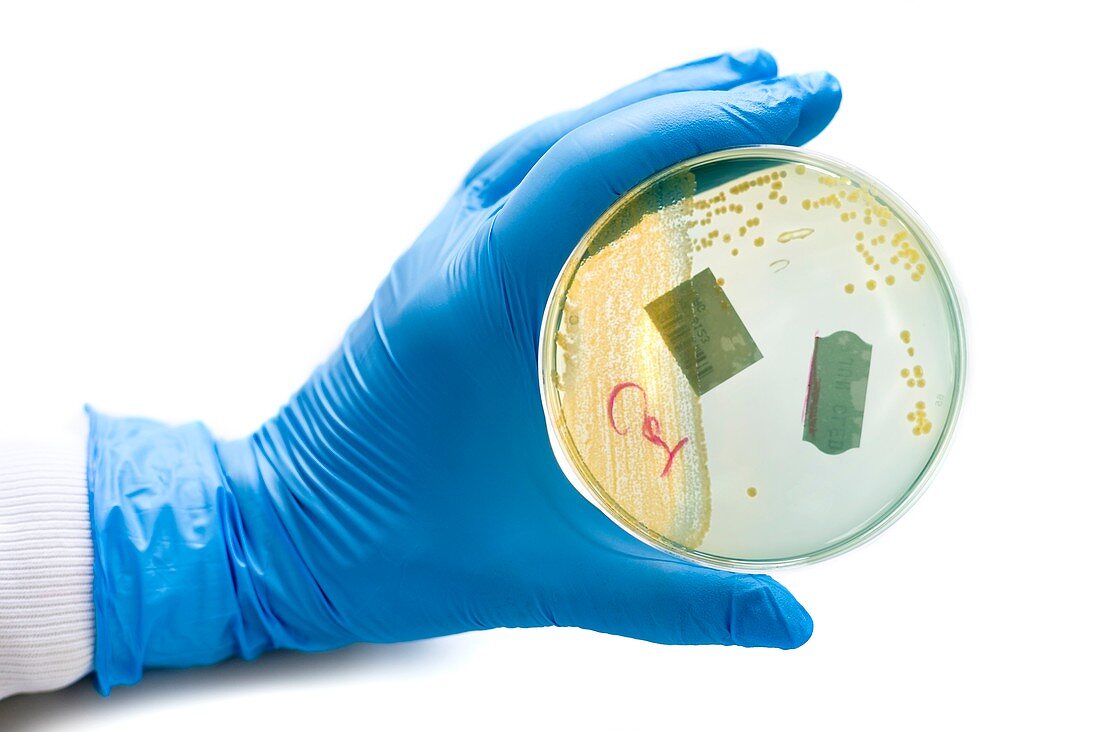 Cultured urinary bacteria