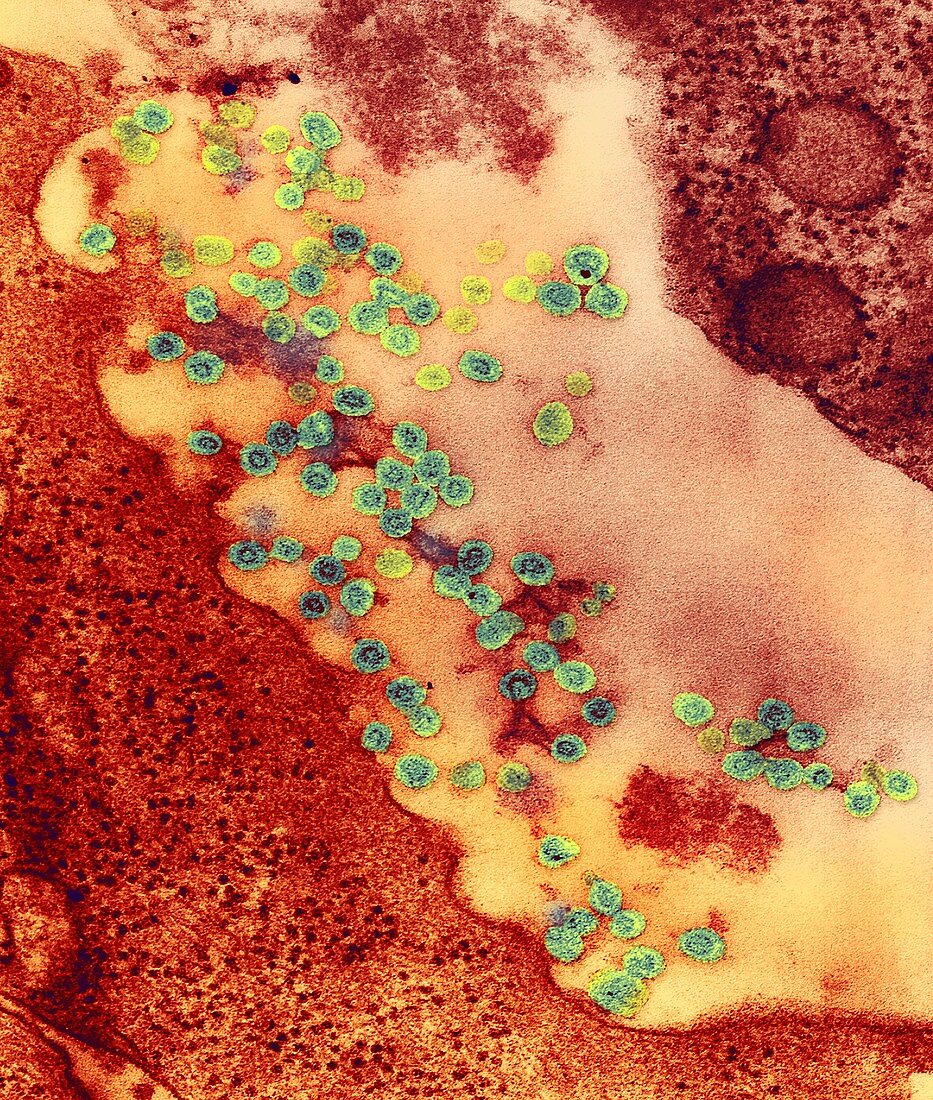 Rubella virus particles,TEM