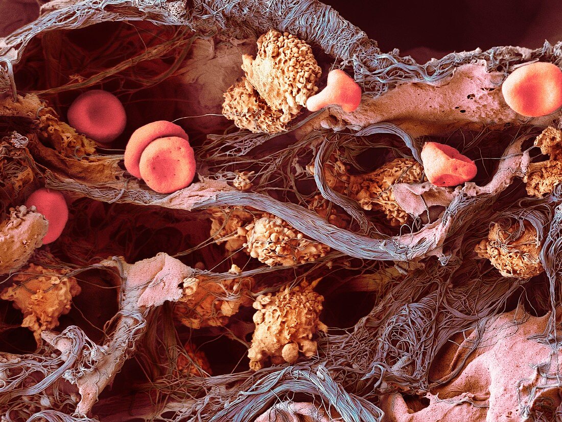 Cells in lung tissue,SEM