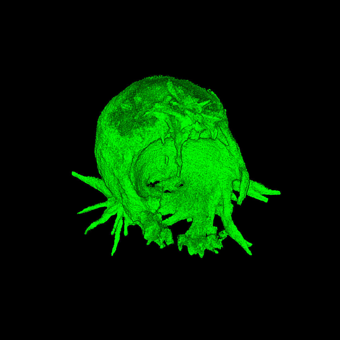 Cell transfection,3D CT scan