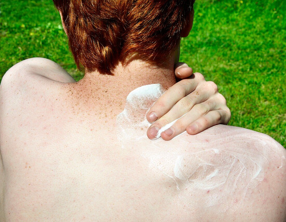 Sunscreen lotion for freckled skin