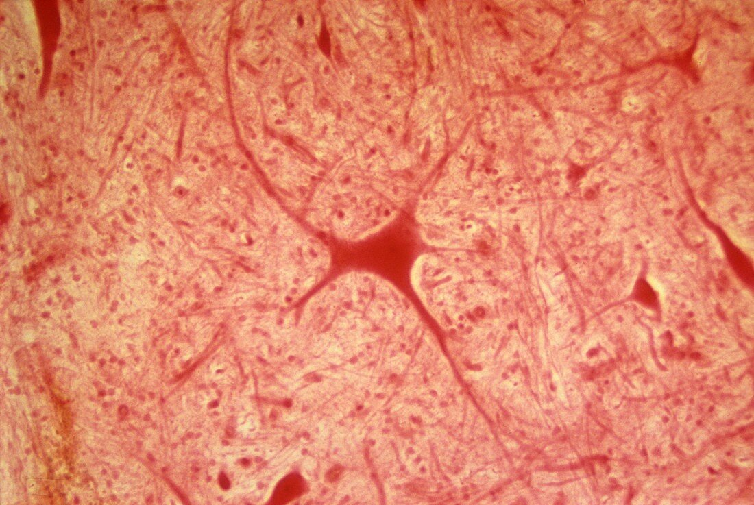 Multipolar neuron,light micrograph