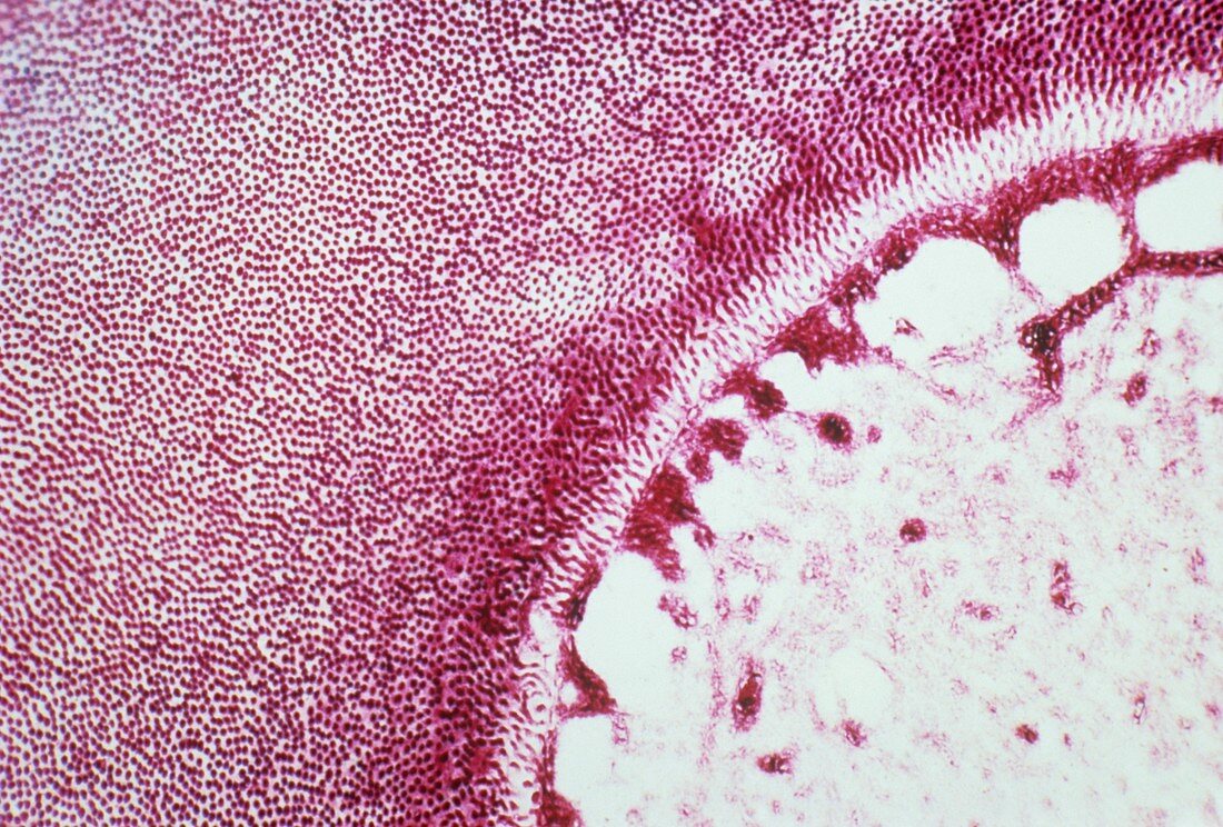 Dentine and pulp,light micrograph