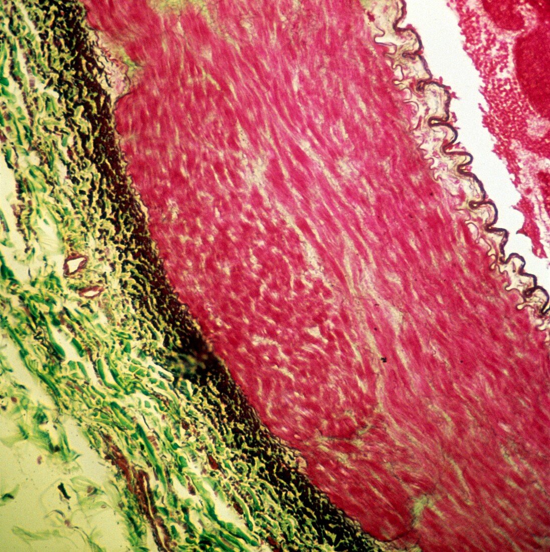 Artery wall,light micrograph
