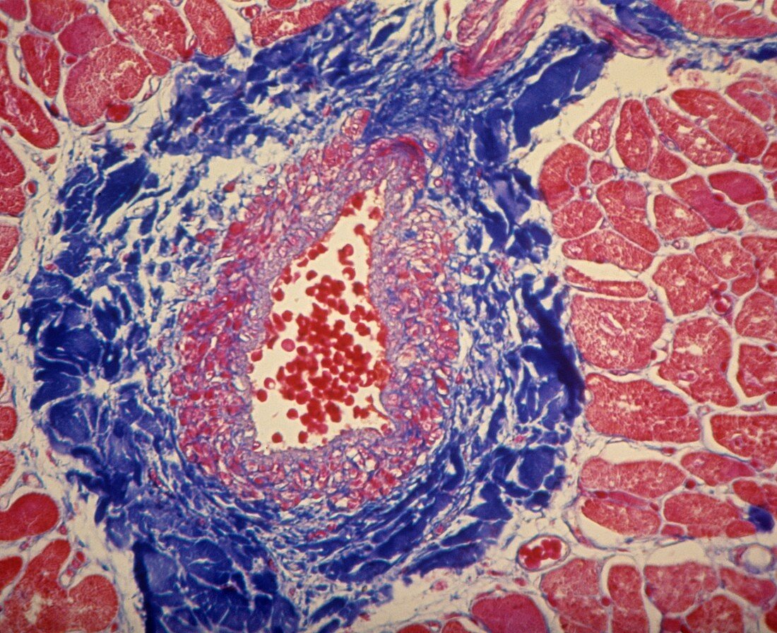 Coronary artery,light micrograph