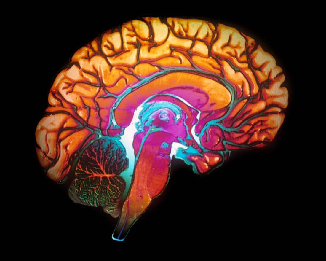 Human brain,3D MRI scan