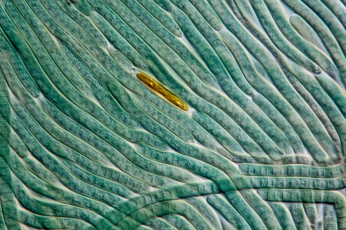 Cyanobacteria and diatom,LM