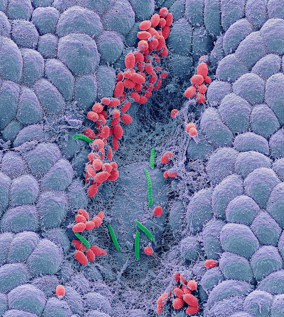 Helicobacter and yeast in stomach,SEM