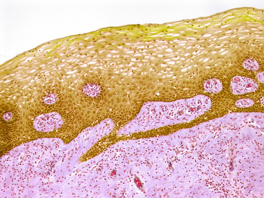 Human cervix,light micrograph