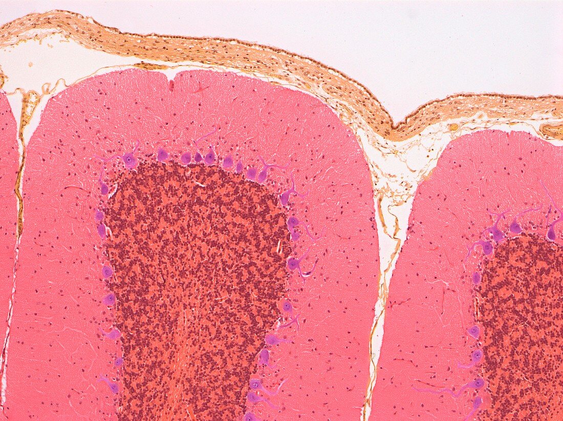 Cerebellum,light micrograph