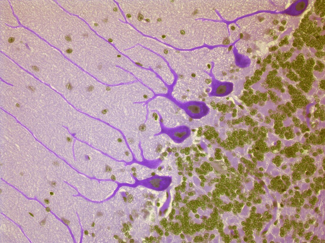 Purkinje nerve cells,light micrograph