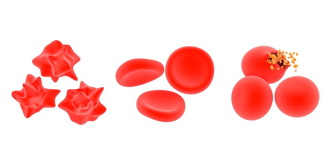 Osmosis in red blood cells,illustration