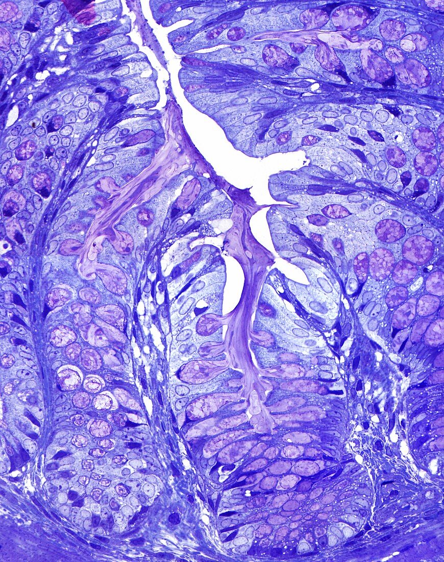 Large bowel glands,light micrograph