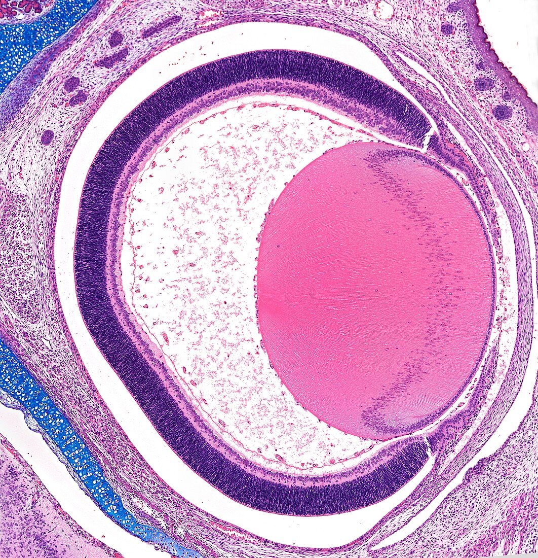Fetal eye,light micrograph