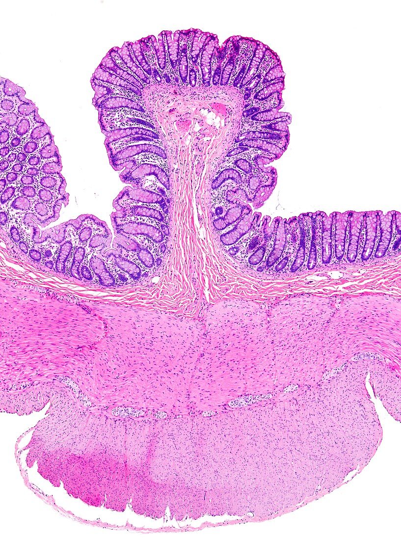 Large bowel,light micrograph