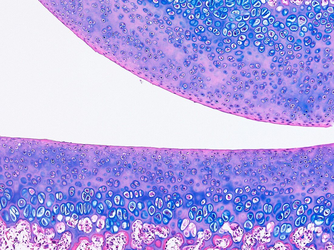 Articular cartilage,light micrograph