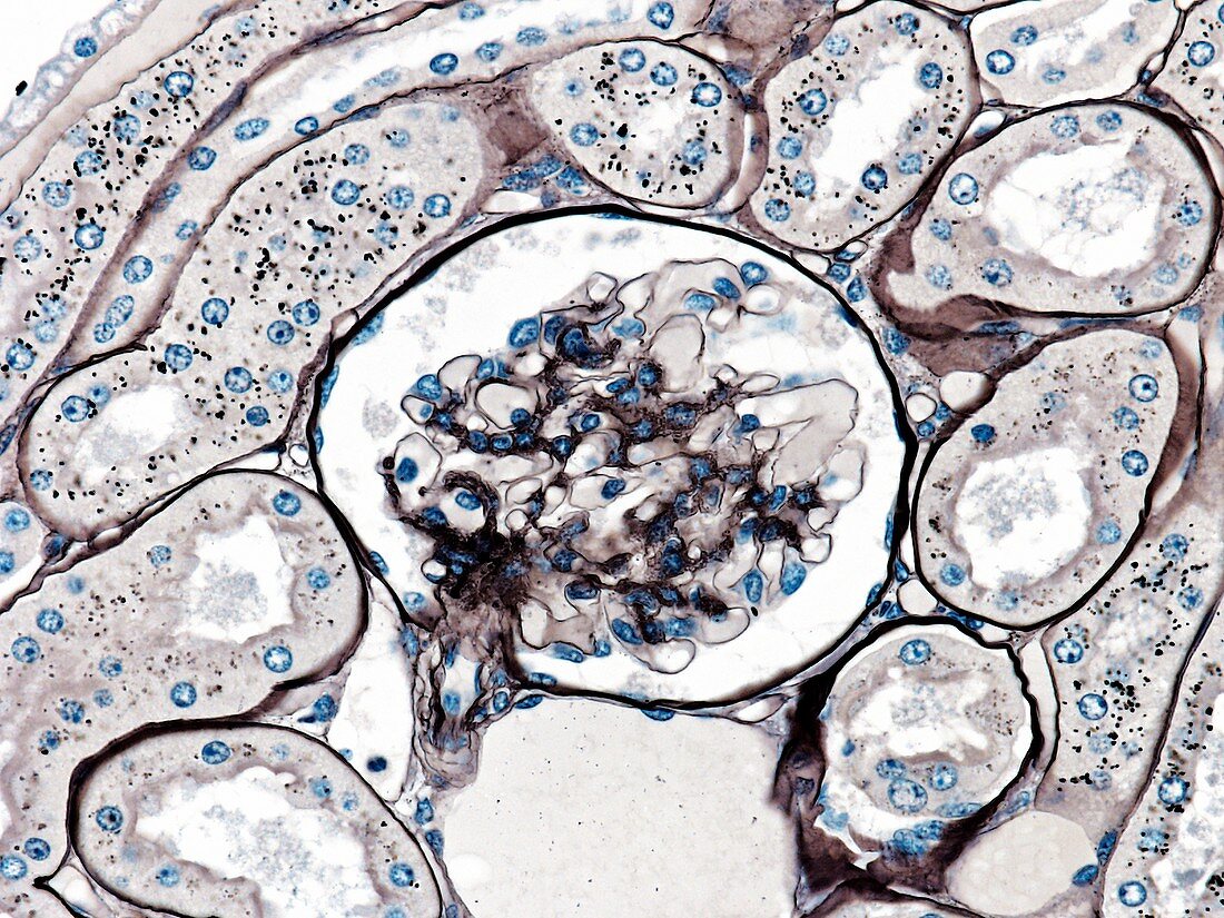 Glomerulus,light micrograph