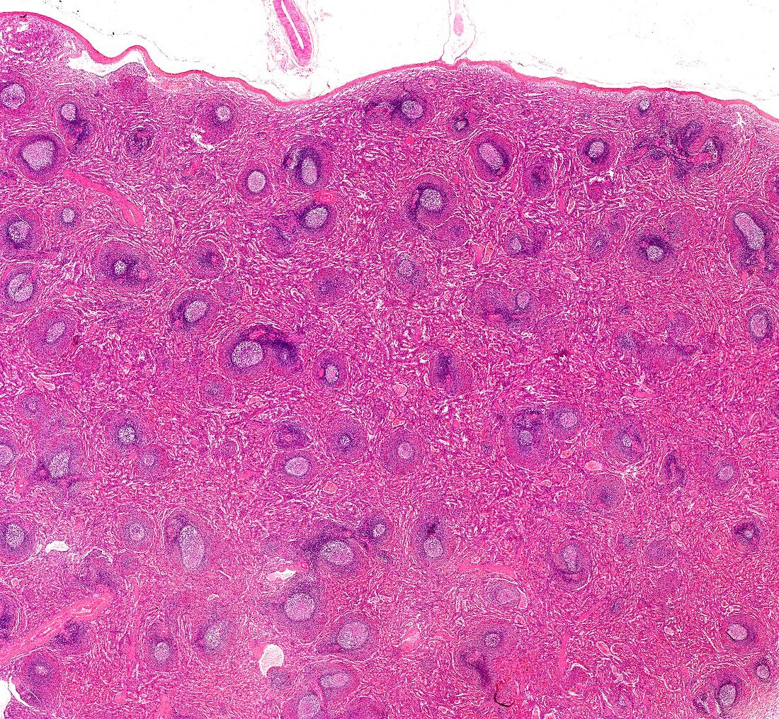 Spleen,light micrograph