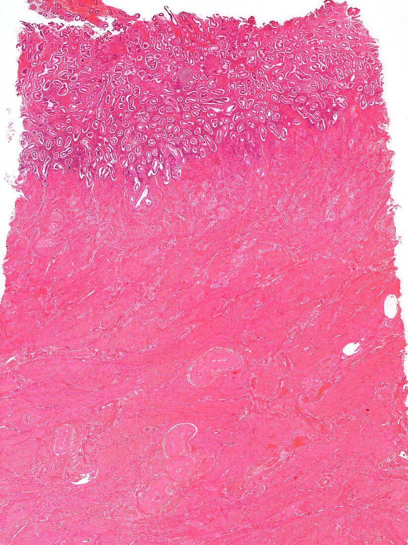Uterus,light micrograph