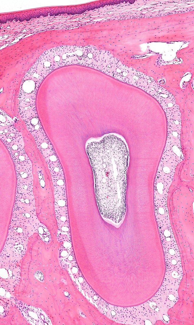 Tooth,light micrograph