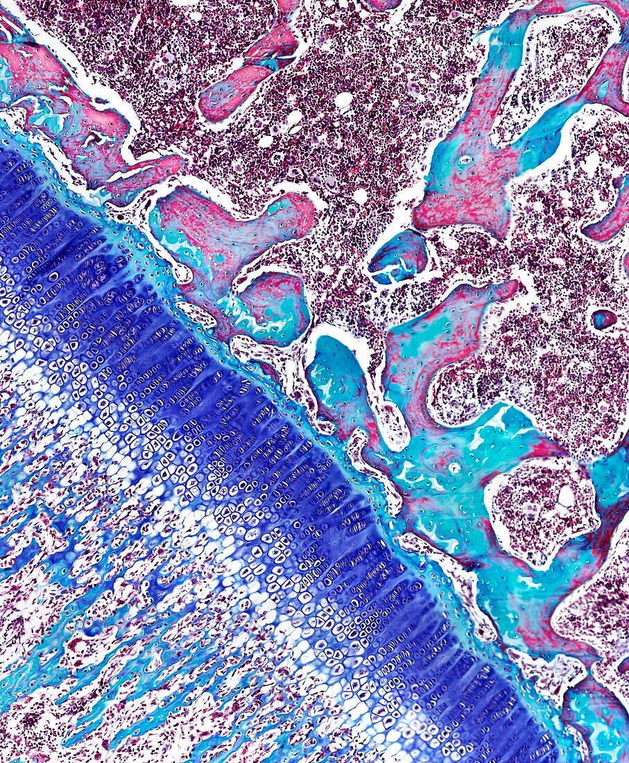 Epiphyseal growth plate,light micrograph