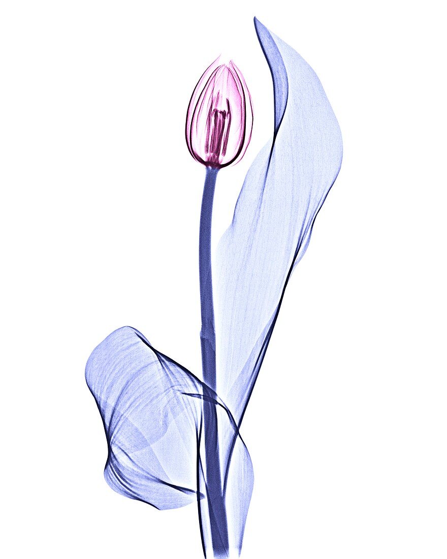 Tulip,X-ray