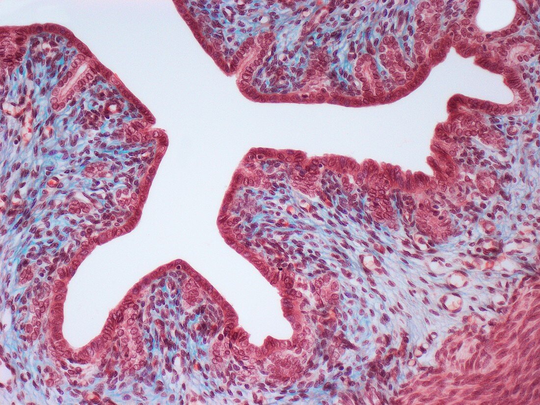 Uterine wall,light micrograph