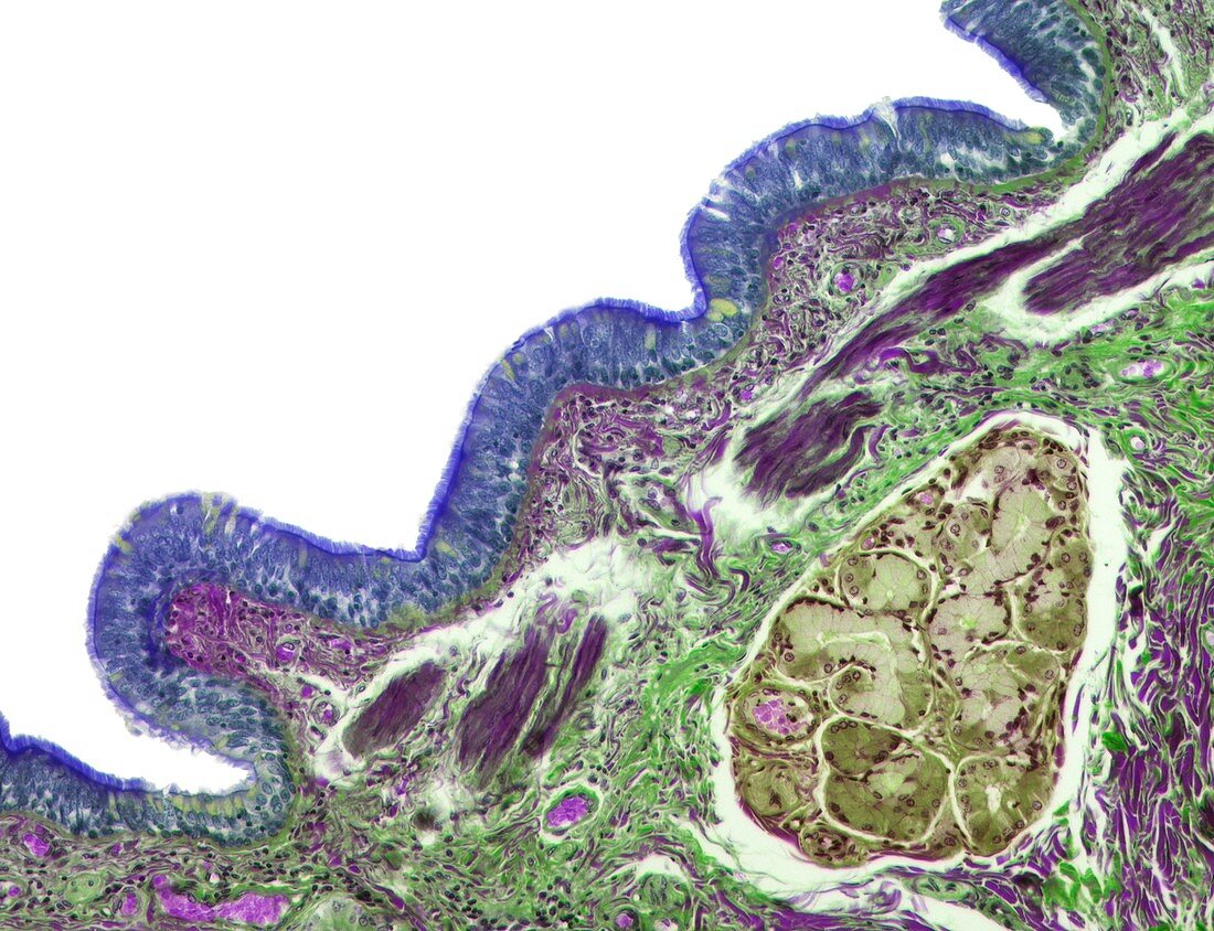 Human lung bronchus,light micrograph