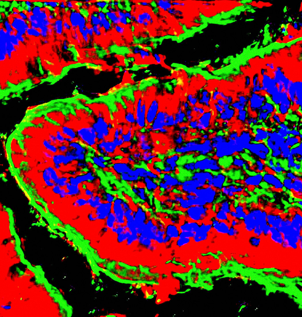 Intestinal villi,fluorescent micrograph