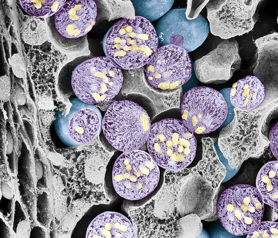Dividing pollen cell,SEM
