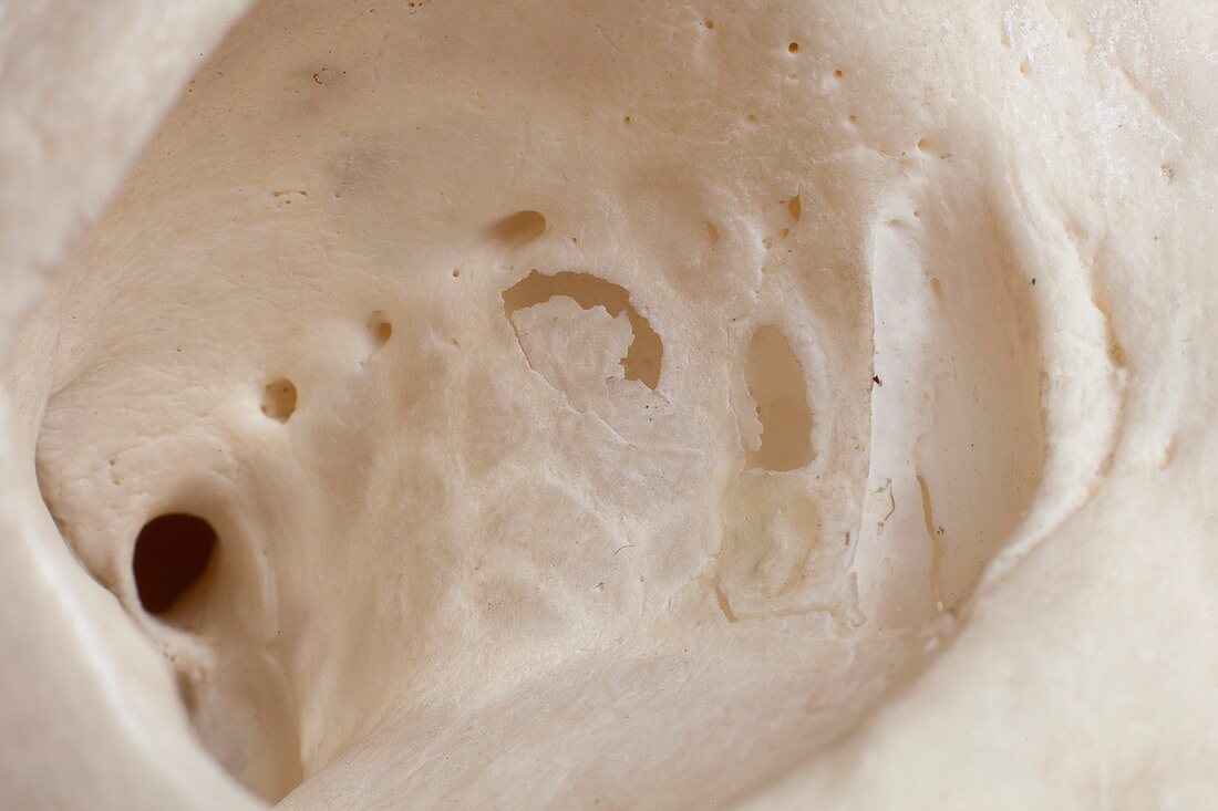 Human skull detail