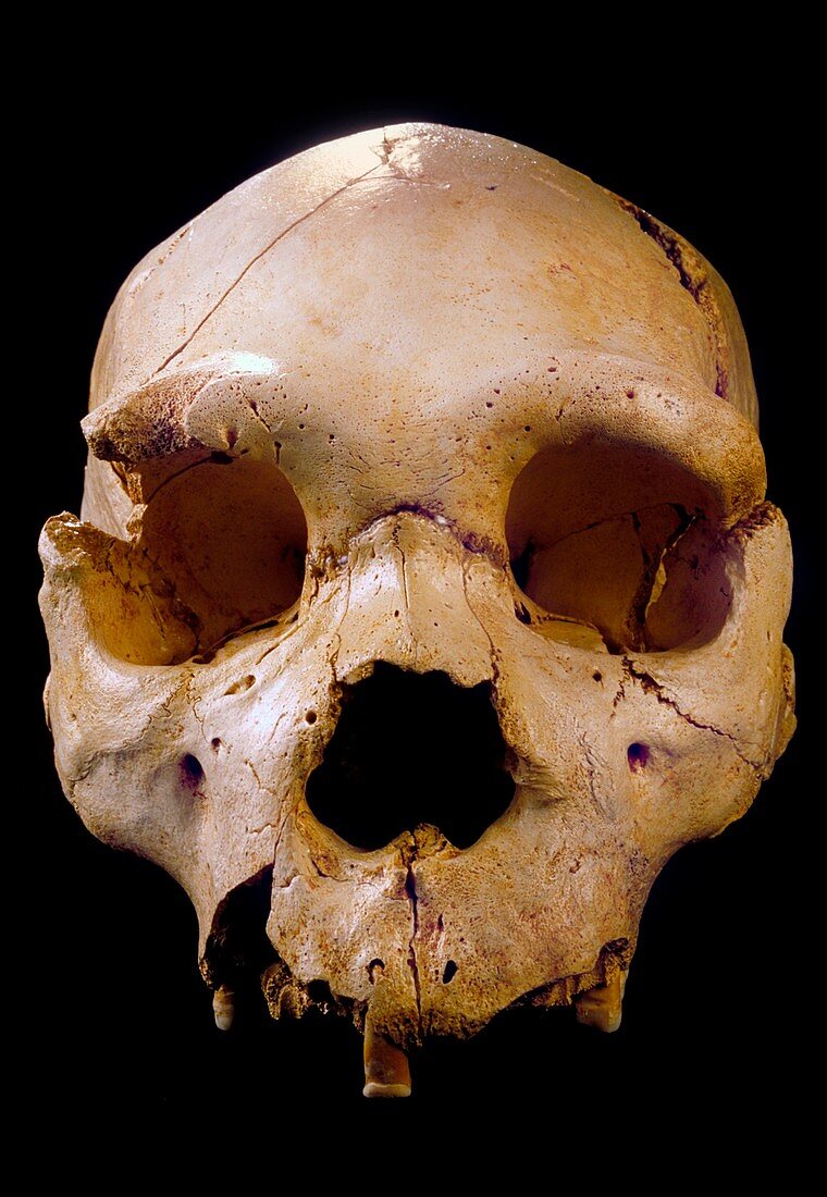 Homo heidelbergensis skull (Cranium 5)