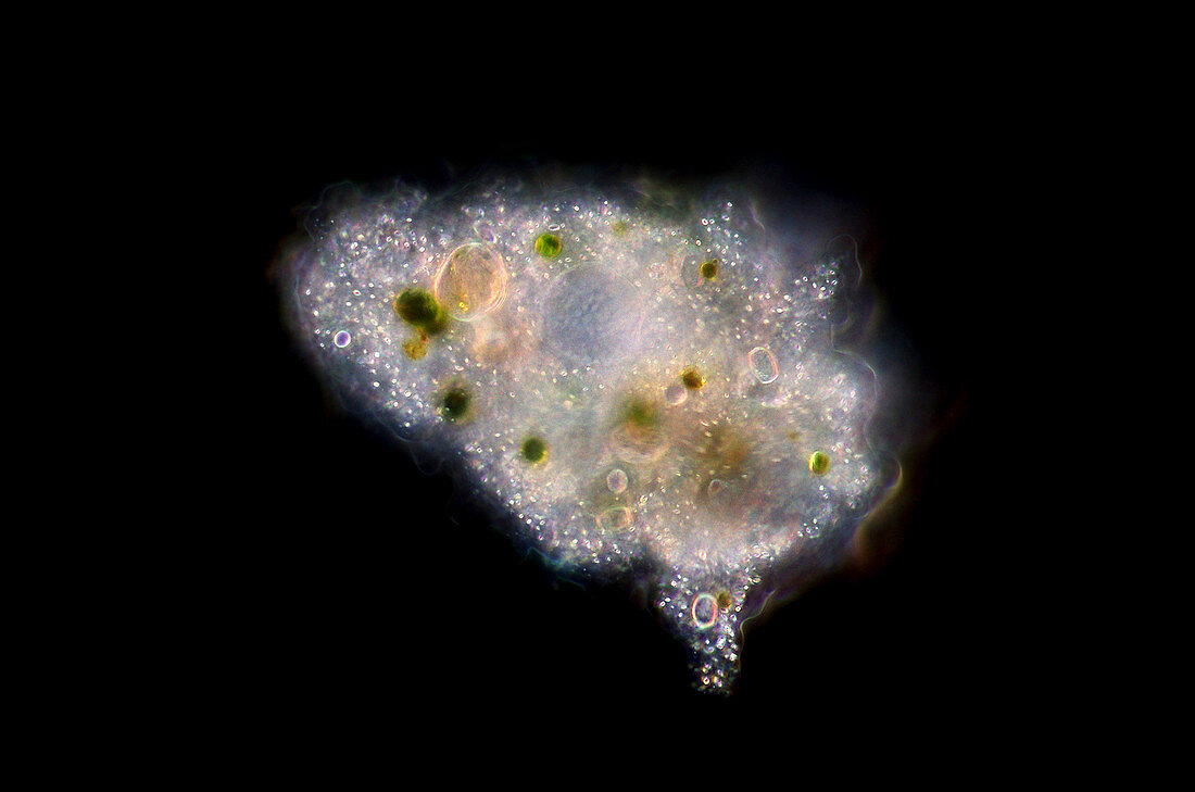 Amoeba,light micrograph