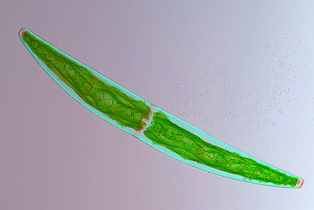 Closterium desmid,light micrograph