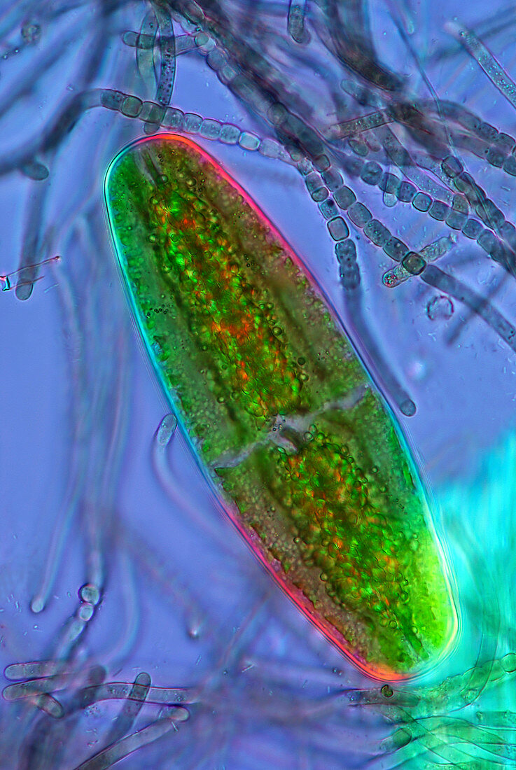 Desmid and Cyanobacteria,micrograph