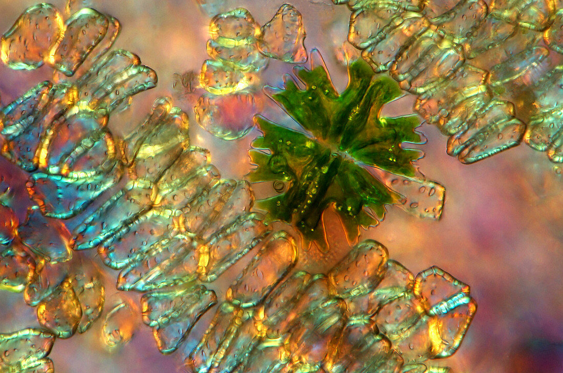 Micrasterias desmid,light micrograph