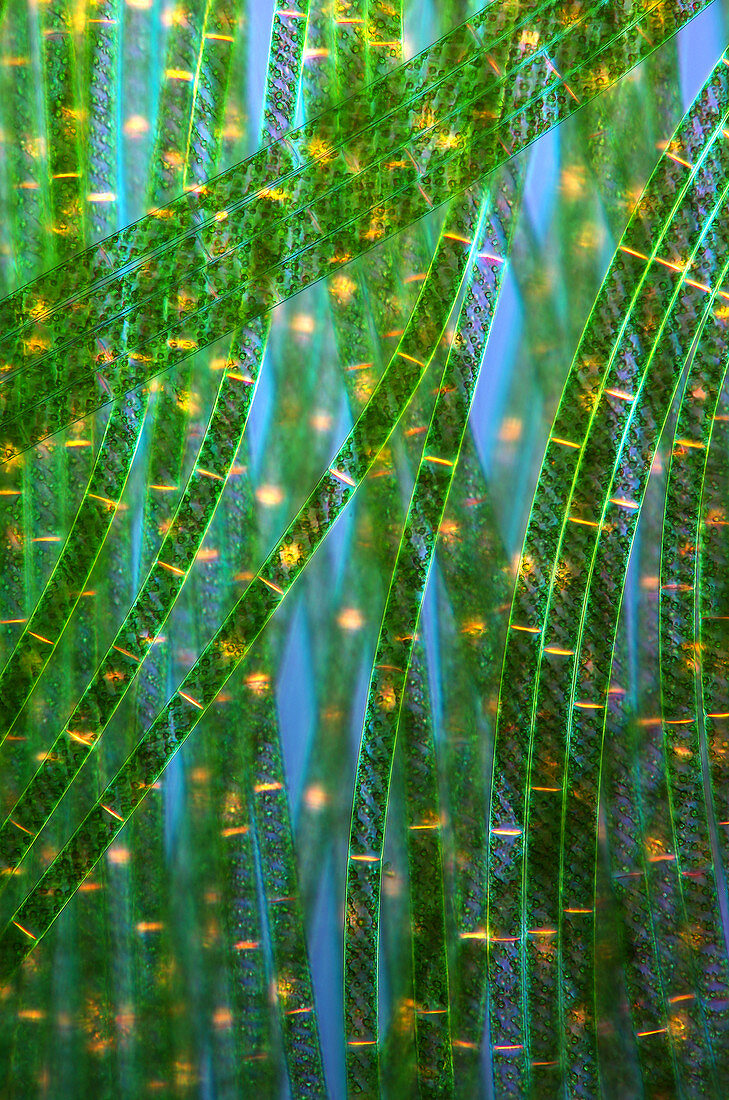 Spirogyra algae,light micrograph