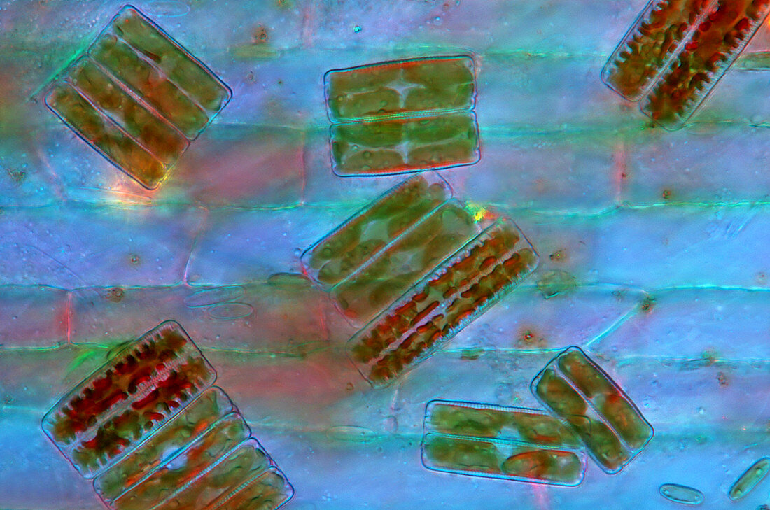 Diatoms,polarised light micrograph