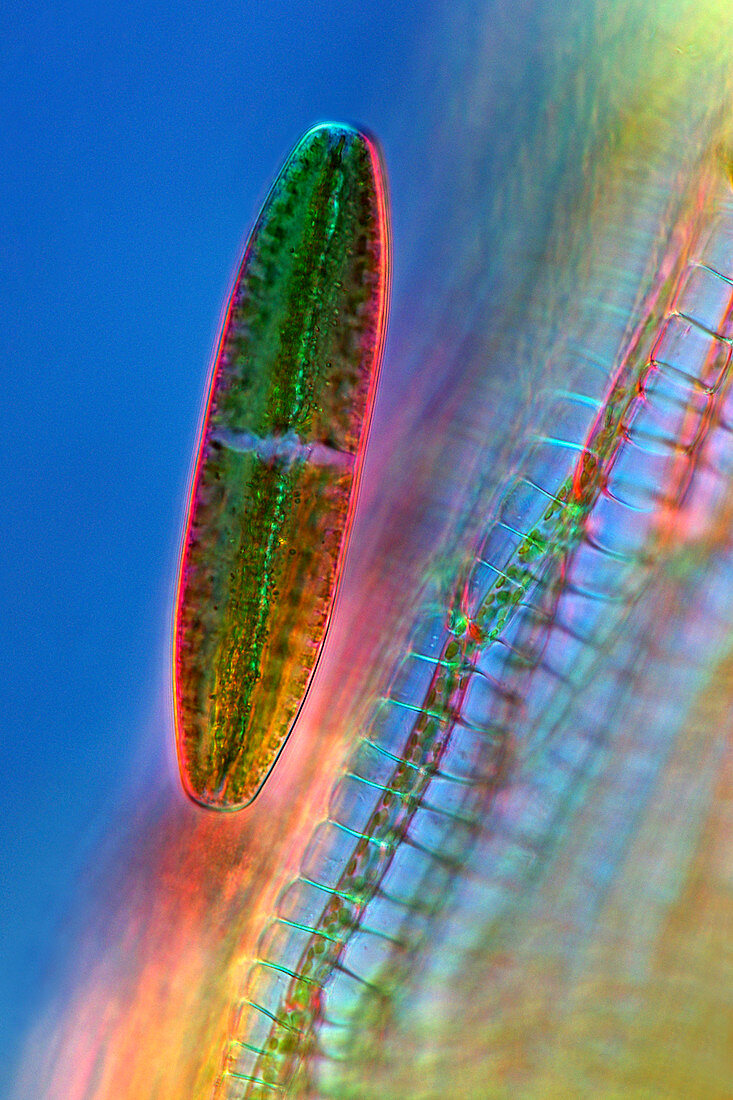 Netrium desmid,light micrograph