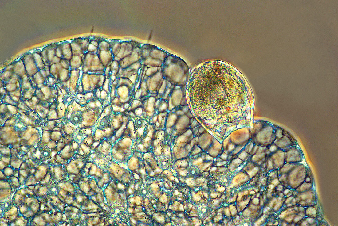 Protozoan ingesting rotifer,micrograph