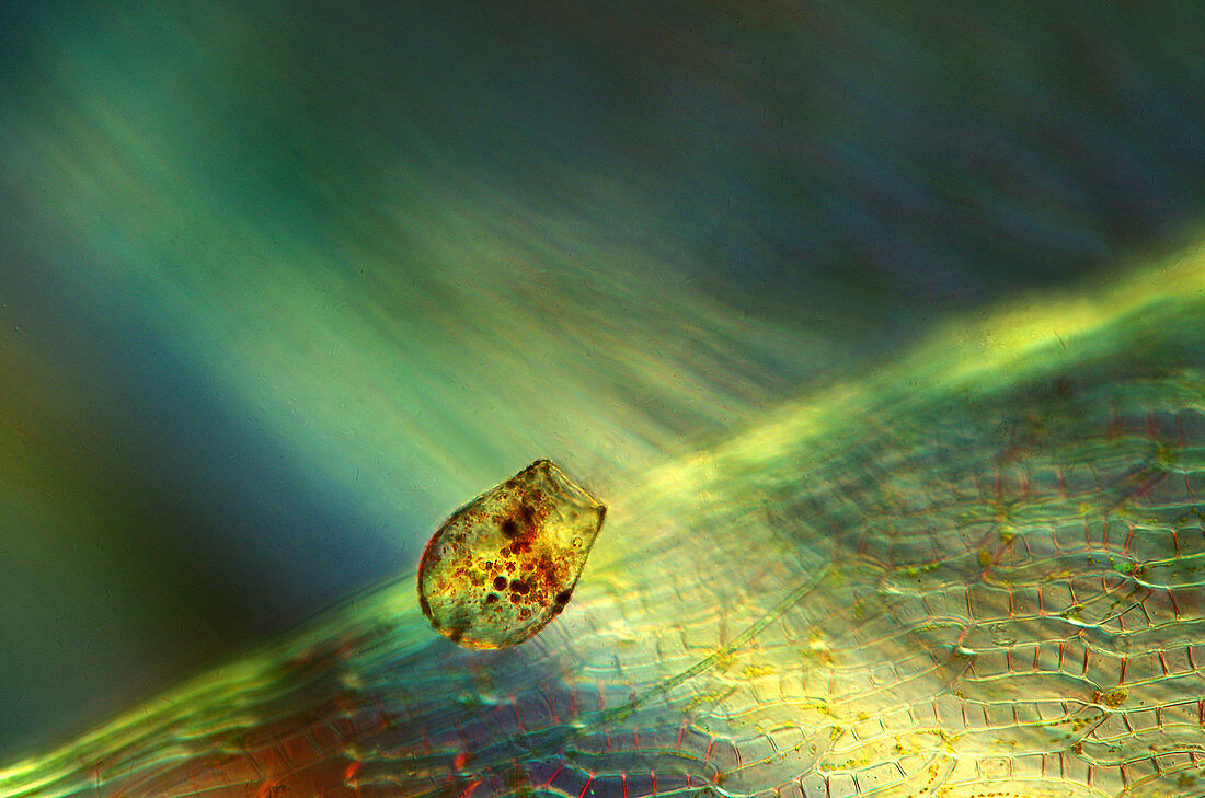 Shelled amoeba,light micrograph