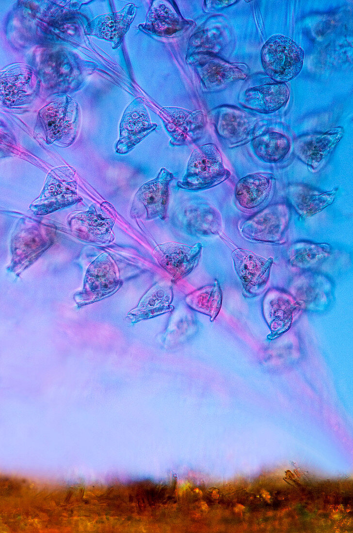 Carchesium colony,light micrograph