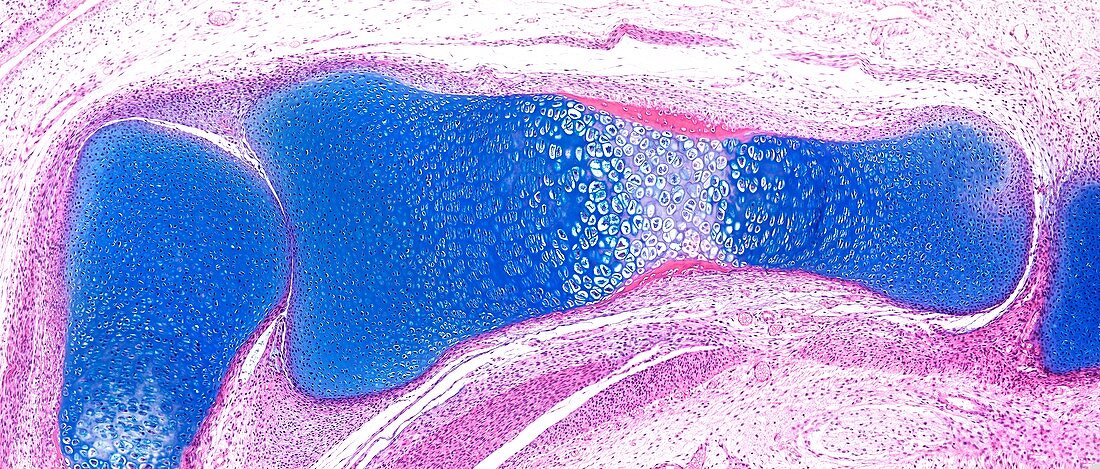 Fetal bone,light micrograph