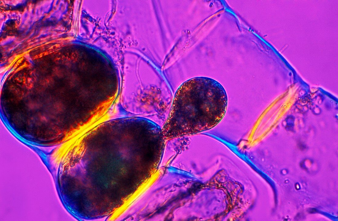 Spirogyra algae,light micrograph